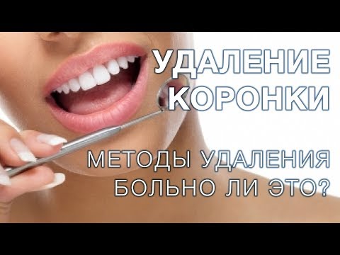 Видео: Зубные коронки / Как снимают зубные коронки?