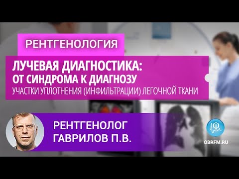 Видео: Рентгенолог Гаврилов П.В.: Лучевая диагностика: участки уплотнения (инфильтрации) легочной ткани