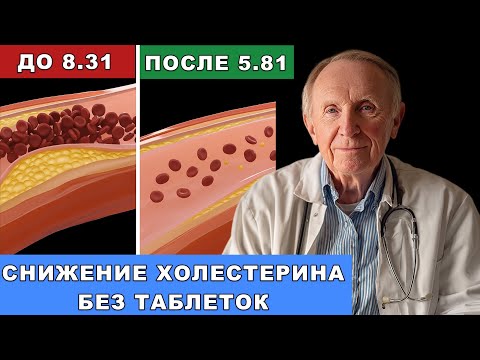 Видео: Доктор с 35-летним стажем: холестерин — не враг! Вот почему таблетки не помогают