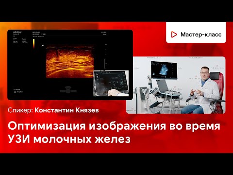 Видео: Оптимизация изображения во время УЗИ молочных желез