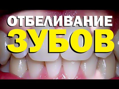 Видео: Галилео. Отбеливание зубов