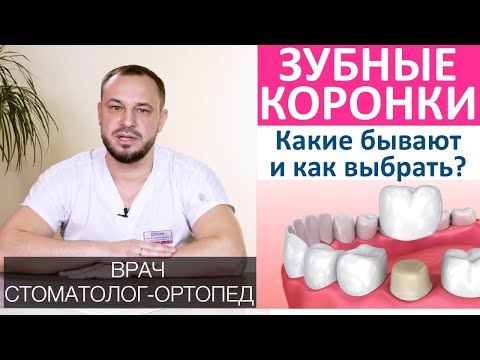 Видео: Все о зубных коронках - металлокерамические , безметалловые и т.д. Циркониевые коронки для зубов.