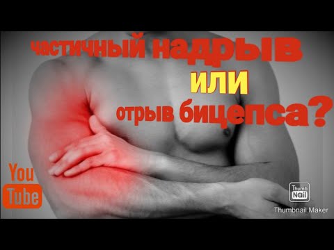 Видео: КАК РАЗ МОЙ СЛУЧАЙ ТРАВМЫ БИЦЕПСА!!!