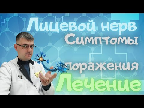 Видео: Лицевой нерв   симптомы поражения, виды лечения