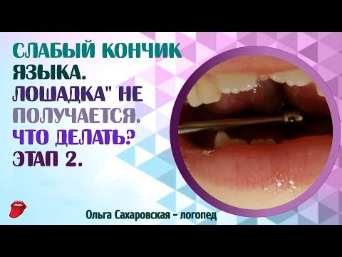 Видео: Слабый кончик языка  "Лошадка" не получается  Что делать? Этап 2