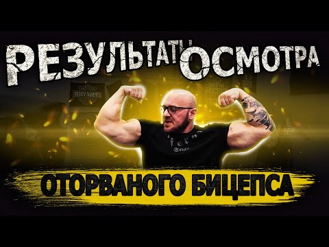 Видео: Результаты осмотра оторваного бицепса