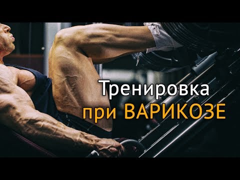 Видео: Варикозное расширение вен: особенность тренировок в зале