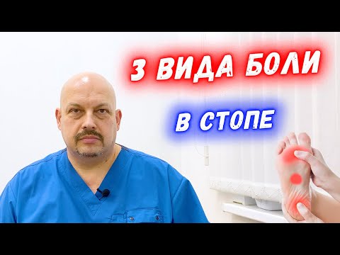 Видео: Боли в стопе: боль в пяточной области, боль в плюсневой части,  боль в середине стопы | Причины