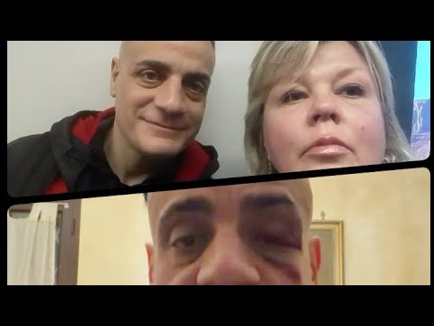 Видео: Избили коллегу блогера Симоне Чикалоне . Рим. 