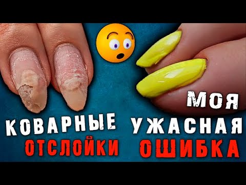 Видео: 😖 ПЛЕШИВЫЕ НОГТИ. Как я НАТУПИЛА на маникюре.Коварные отслойки.Скрученные ногти.Наращивание БЕЗ ФОРМ