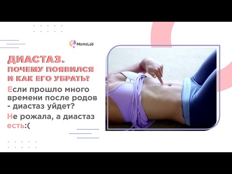 Видео: Диастаз после родов или диастаз прямых мышц: что делать, если у вас расхождение прямых мышц живота