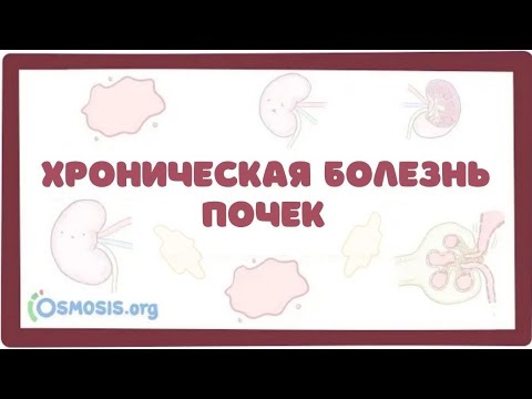 Видео: Хроническая Болезнь Почек (ХБП, ХПН) - причины, симптомы, клиника, лечение (лекция)