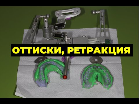 Видео: ОРТОПЕДИЧЕСКАЯ СТОМАТОЛОГИЯ ОТТИСКИ, РЕТРАКЦИЯ (перезалив)