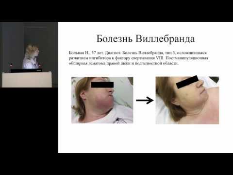 Видео: Диагностика гемостаза с помощью тромбоэластографии  и тромбоэластометрии Полеводова О А