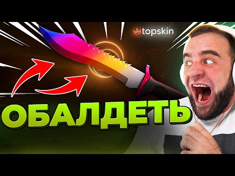 Видео: 🔥 TOPSKIN ВЫБИЛ НОЖ за 150.000р в КС ГО - ОБАЛДЕТЬ - ДО НОЖА в КС ГО на TOPSKIN
