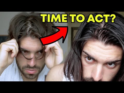 Видео: Мои волосы всё ещё редеют? | Моя стратегия борьбы с выпадением волос (руководство)