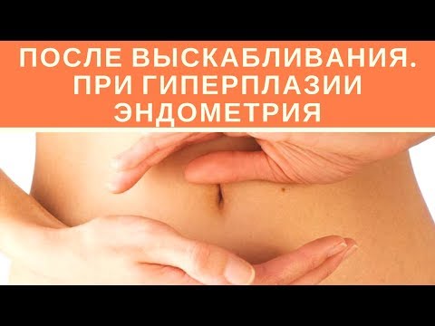 Видео: Гиперплазия Эндометрия. Что будет после выскабливания?