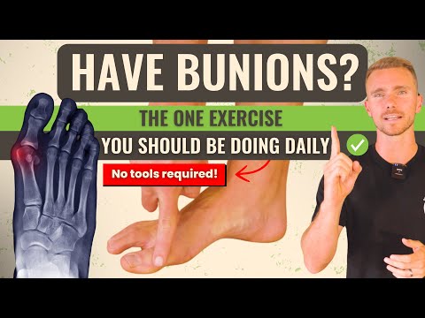 Видео: Ежедневное упражнение №1 от косточек на ногах — без инструментов!