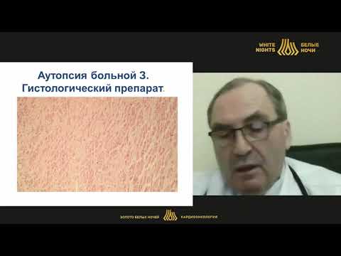Видео: Поражения сердца, возникающие на фоне противоопухолевого лечения, и их профилактика (Гендлин Г.Е.)