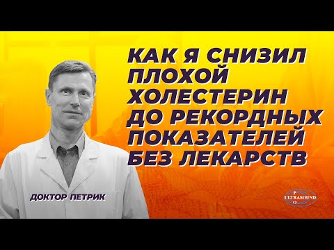 Видео: Как я снизил плохой холестерин до рекордных показателей без лекарств.