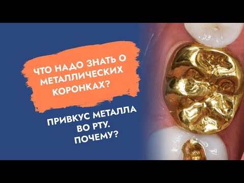 Видео: Что надо знать о металлических коронках? Привкус металла во рту. Почему?