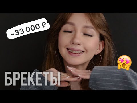 Видео: Я поставила брекеты!