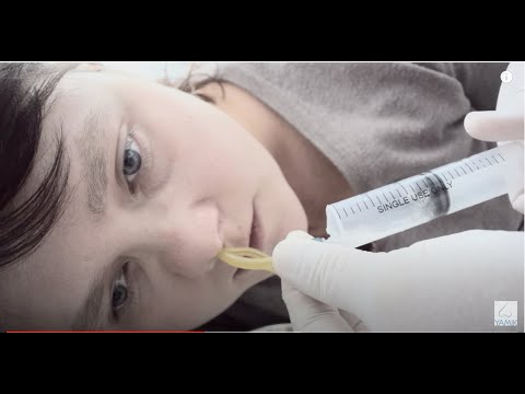 Видео: Лечение гайморита у взрослых. Проведение ЯМИК процедуры при лечении гайморита без  прокола.