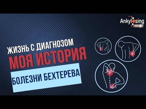 Видео: Жизнь с диагнозом болезнь Бехтерева|Моя история