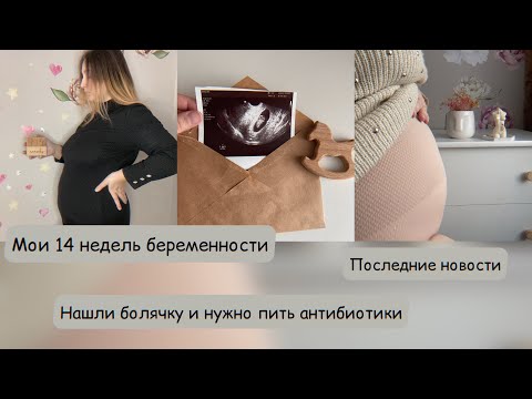 Видео: Мои 14 недель беременности|О гендер пати|Последние новости|Нашли болячку и нужно пить антибиотики