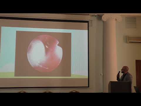 Видео: 10 Иванов ГВ Инородные тела ЖКТ в педиатрической эндоскопии