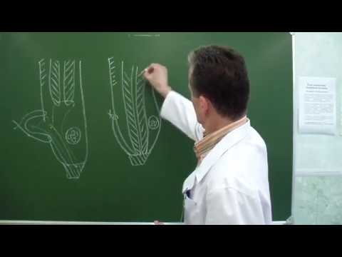 Видео: Пластика передней стенки пахового канала по Жирару