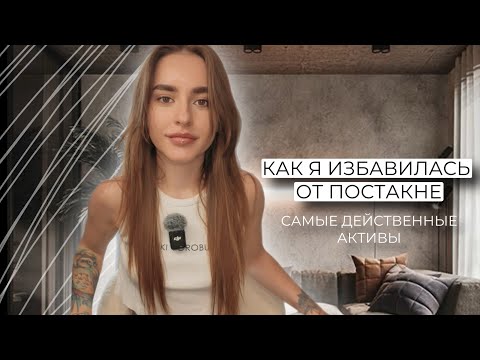 Видео: Как избавиться от постакне и пигментации