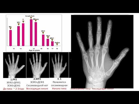Видео: Фазы роста по кисти