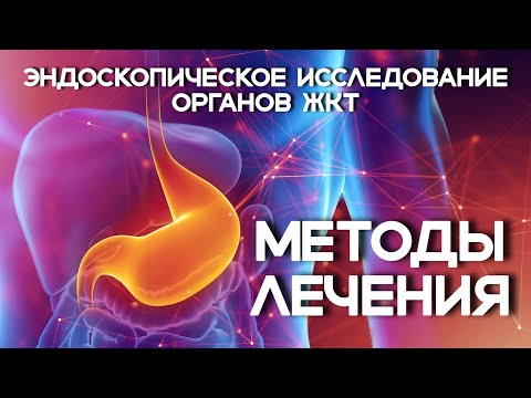 Видео: Этот желудок мы исследовали с особым пристрастием
