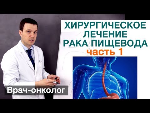 Видео: Рак пищевода - хирургическое лечение рака пищевода. Часть 1. Формы рака пищевода, причины