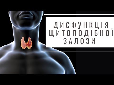 Видео: Порушення функції щитоподібної залози. Ознаки. Вузли на щитовидці | Ранок надії