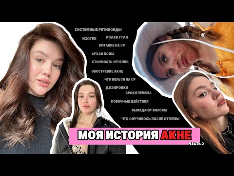 Видео: СИСТЕМНЫЕ РЕТИНОИДЫ / РОАККУТАН / ИЗОТЕК / ПОБОЧНЫЕ ДЕЙСТВИЯ — моя история лечения акне
