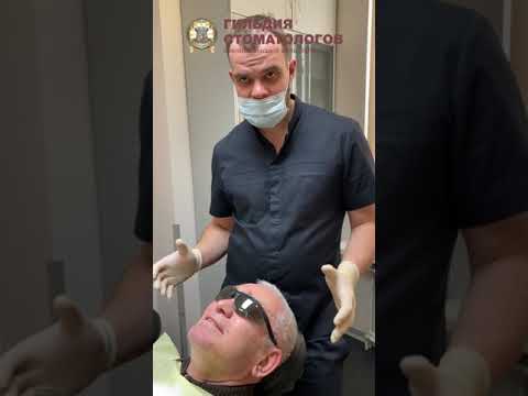 Видео: Имплантация зубов все на четырёх в Санкт-Петербурге. Клинический случай, часть 5