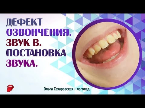 Видео: Дефект озвончения. Звук В. Что делать, если ребёнок оглушает согласные звуки?