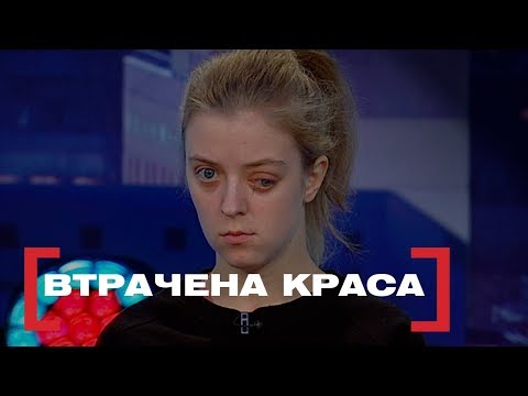 Видео: ВТРАЧЕНА КРАСА. Стосується кожного. Ефір від 28.02.2019