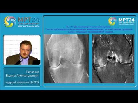 Видео: «Воспалительные изменения костно-суставной системы».
