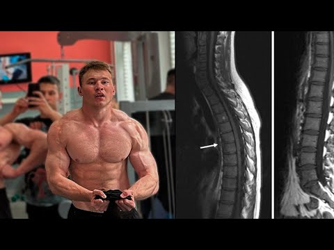 Видео: TATWOLE ИНВАЛИД В 19 ЛЕТ ! НЕ ПОВТОРЯЙ ЕГО ОШИБОК !