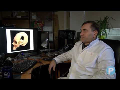 Видео: КАК ПОЧИНИТЬ ГОЛОВУ. Оперативные вмешательства на мозговом отделе головы