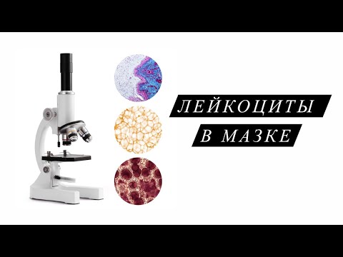 Видео: «Повышенные» лейкоциты в мазке.