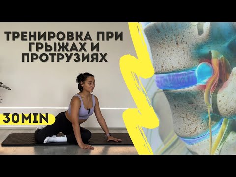 Видео: Как тренироваться, если у вас есть грыжи или протрузии? | База для здоровья позвоночника