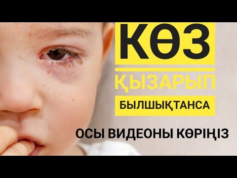 Видео: Баланың көзі былшықтанса көз қызарып қышыса не істеу керек