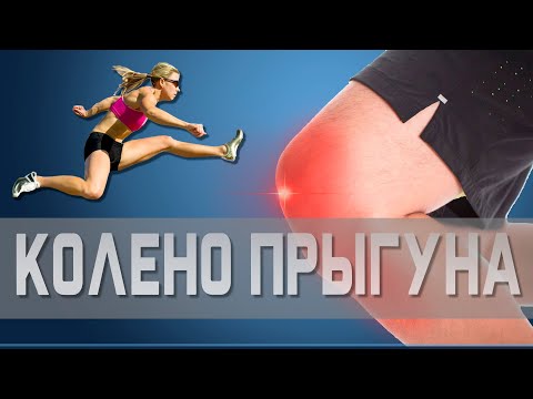 Видео: Что такое ТЕНДИНИТ коленного сустава и как его вылечить | Доктор Демченко