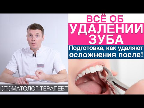 Видео: Удаление зуба - как проходит, больно ли удалять зуб, обезболивание, рекомендации после удаления зуба