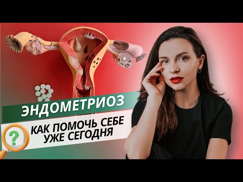 Видео: ЭНДОМЕТРИОЗ. Как помочь себе уже сегодня