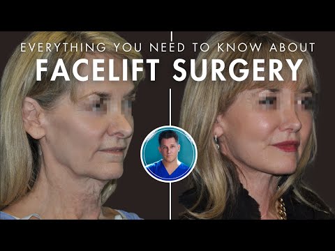 Видео: Подтяжка лица 101: до и после восстановления, глубокая подтяжка лица + подтяжка лица стволовыми к...